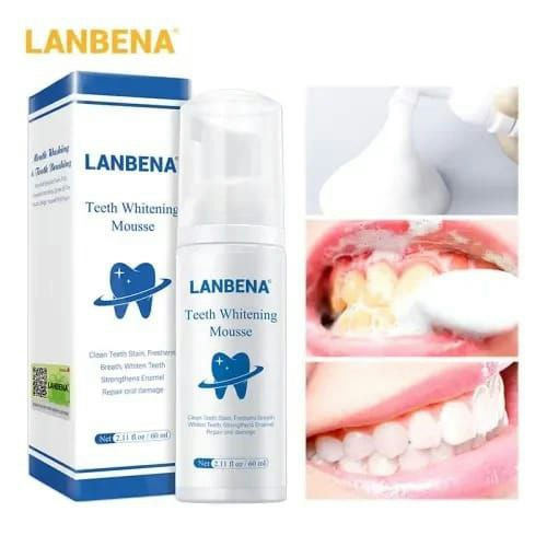 رغوة تبييض الأسنان من Lanbéna 2